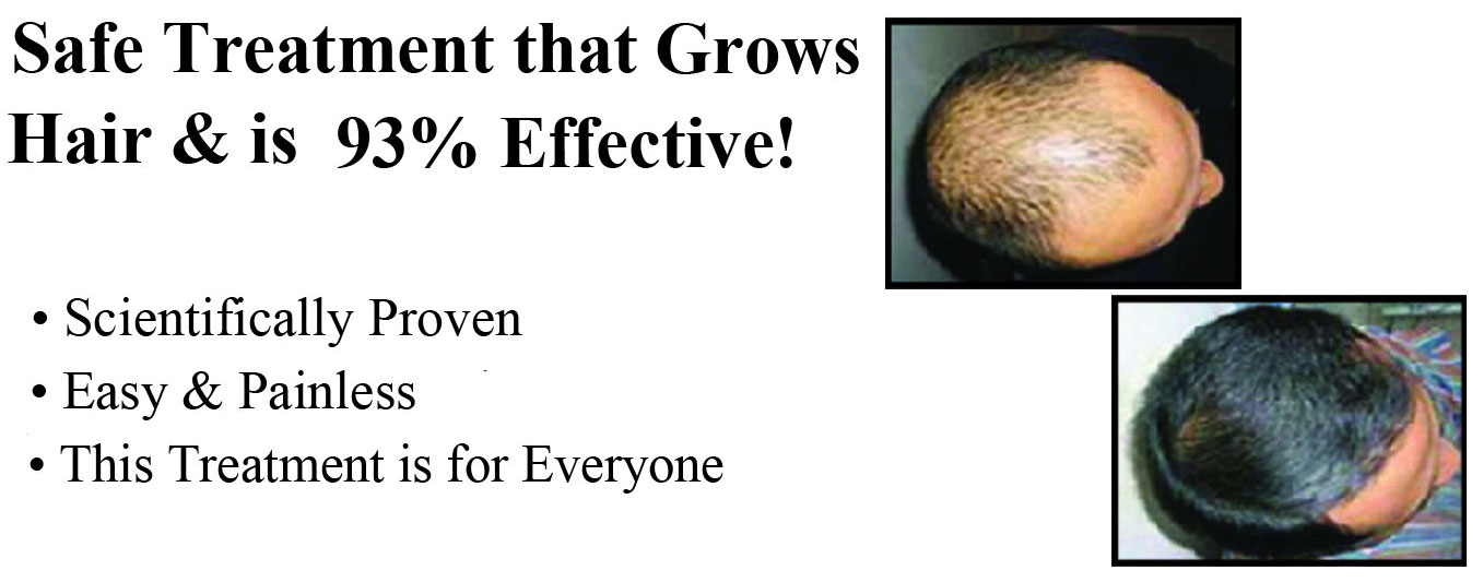 Hair Regrowth Treatments at The Payne Center of Washington